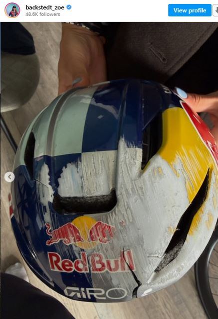 Зои Бэкстедт пропустит старт сезона велокросса из-за падения на тренировке Зои Бэкстедт пропустит старт сезона велокросса из-за падения на тренировке